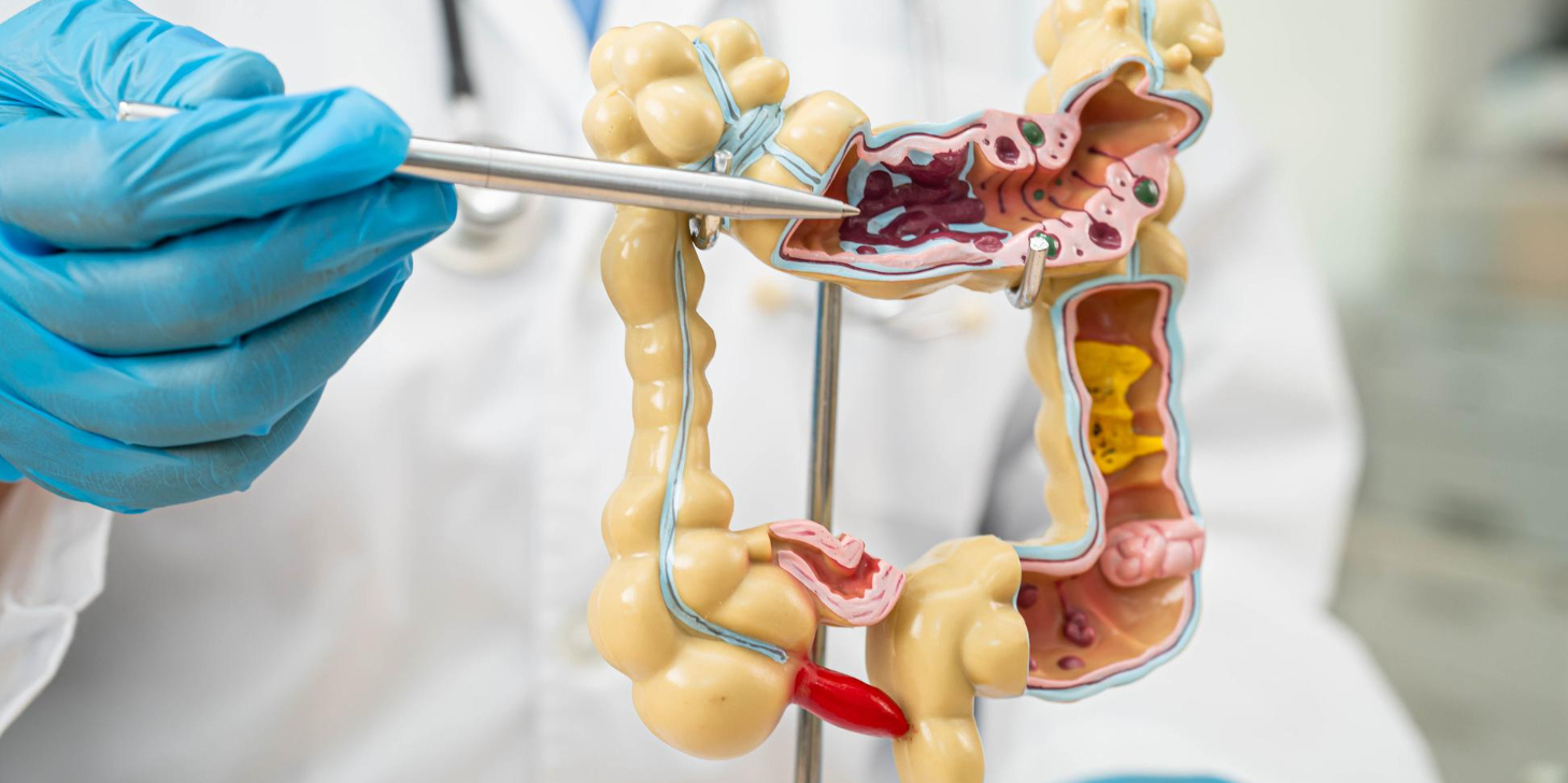 Colorectal Surgery in Anna Nagar